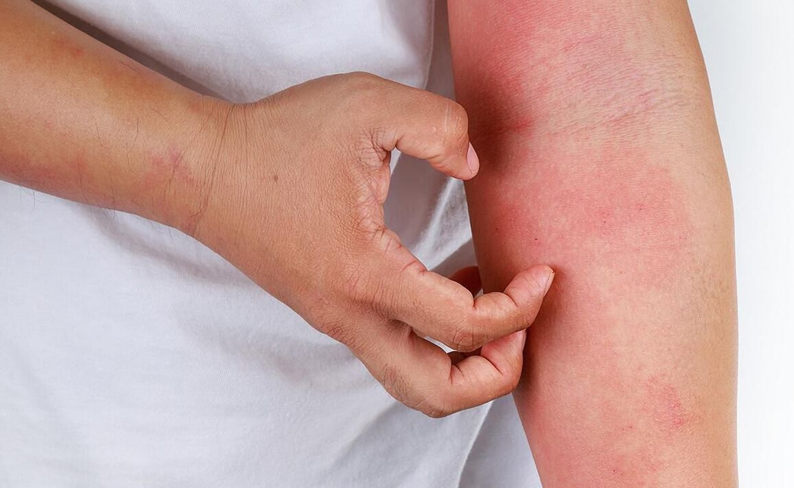 πιθανές επιπλοκές από τη χρήση σόδας